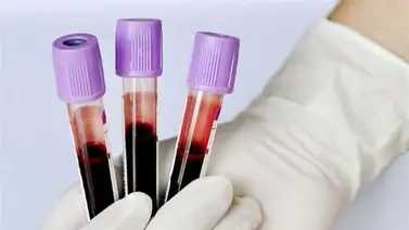 Remedios naturales para depurar la sangre fácilmente Remedios naturales para depurar la sangre fácilmente
