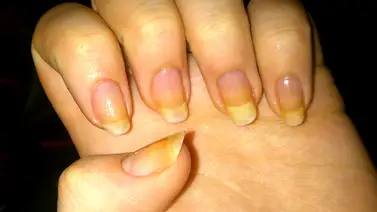 Desmancha las uñas fácilmente con estos ingredientes Desmancha las uñas fácilmente con estos ingredientes