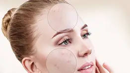 Claves para eliminar manchas del rostro
