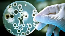 Hongo negro: te contamos todo sobre este tipo de infección